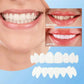 Veenora™ Clip-on Veneers